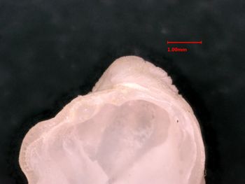 Media type: image;   Malacology 7986 Description: inside view of valve with close up of hinge;  Aspect: interior
